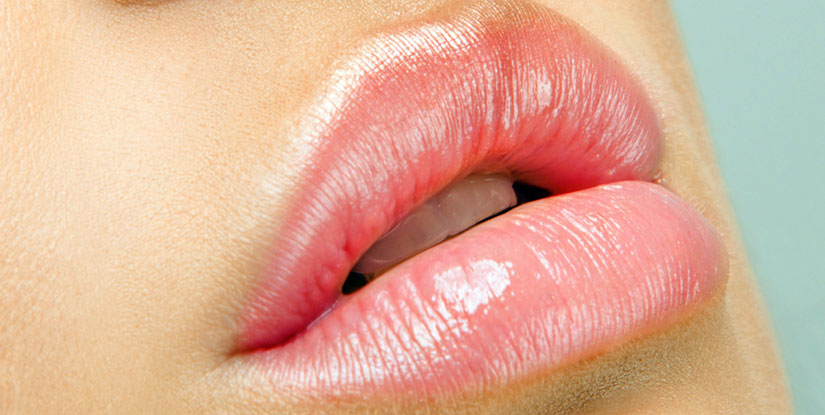 Injection des lèvres avec de l'acide hyaluronique à Paris - Dr Benachour